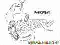 Pancreatic Cancer Printable Coloring Page Cancer De Pancreas Para Colorear E Imprimir