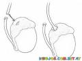 Vasectomy Reversal Procedure Coloring Page
