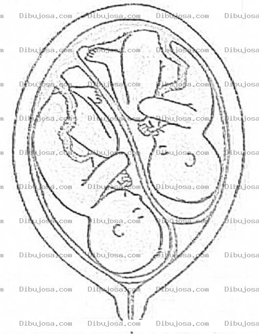 Dibujo para colorear Mellizos Dibujo De Gemelos En El Vientre Para Pintar Y Colorear Embarazo De Mellisos