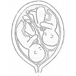 Dibujo para colorear Mellizos Dibujo De Gemelos En El Vientre Para Pintar Y Colorear Embarazo De Mellisos