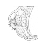 Dibujo para colorear Plantar Fasciitis Coloring Page