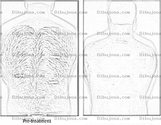 Dibujo para colorear Hair Removal In Washington Dc Coloring Page To Print