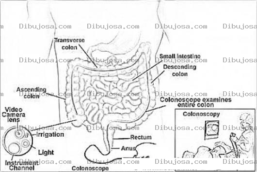 Dibujo para colorear Colonoscopia Y Colonoscopio Para Pintar Y Colorear El Procedimiento De Un Examen De Colon Irritable