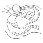 Dibujo para colorear Parto Por Cesarea En Hospital Dibujo De Operacion De Un Parto Por Cesarea Del Nacimiendo De Un Bebe Para Pintar Y Colorear