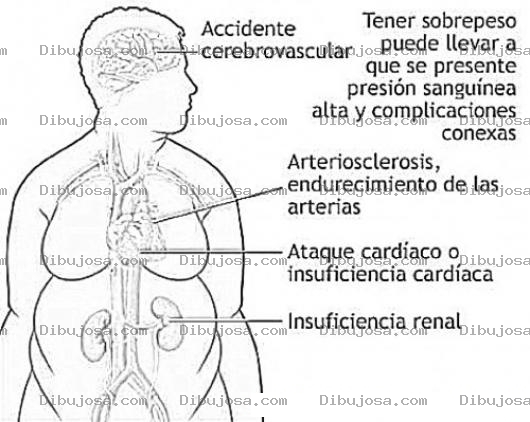 Dibujo para colorear Enfermedades Del Sobrepeso Dibujo De Los Riesgos De La Obesidad Para Pintar Y Colorear Problemas Del Exeso De Peso En Masa Corporal Para Pintar Y Colorear