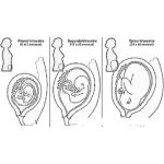Dibujo para colorear Embarazo Por Meses Dibujo De La Evolucion Del Embarazo Y Etapas Del Embarazo Por Trimestres Para Pintar Y Colorear Bebe A Los 3 Meses A Los 6 Meses Y A Los 9 Meses