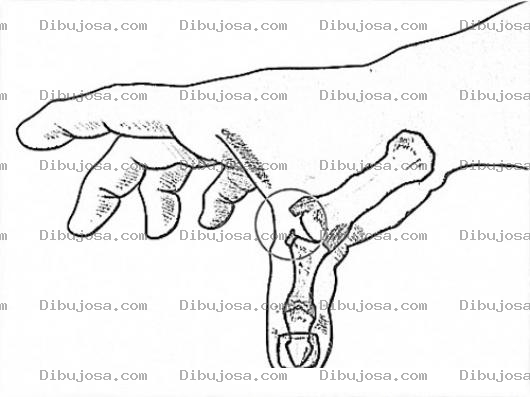 Dibujo para colorear Fratura Dedo Pulgar Dibujo De Quebradura Del Dedo Gordo Pulgar Para Pintar Y Colorear