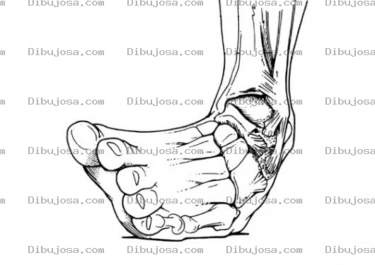 Dibujo para colorear Torcedura De Tobillo Esguince Dibujo De Pie Doblado Para Pintar Y Colorear Pie Desguinsado Torcedura De Tobillo