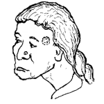 Dibujo para colorear Mujer Con Herpes En La Cara Para Colorear