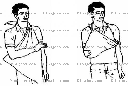 Dibujo para colorear Como Hacer Un Cabestrillo Con Una Toalla O Con Una Sabana Para Inmobilizar Un Brazo Quebrado O Lastimado