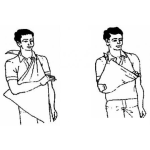 Dibujo para colorear Como Hacer Un Cabestrillo Con Una Toalla O Con Una Sabana Para Inmobilizar Un Brazo Quebrado O Lastimado
