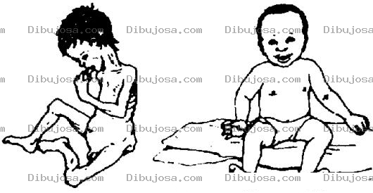 Dibujo para colorear Dibujo De Bebe Desnitrido Y Con Parasitos Y Un Bebe Sano Y Saludable Para Pintar Y Colorear